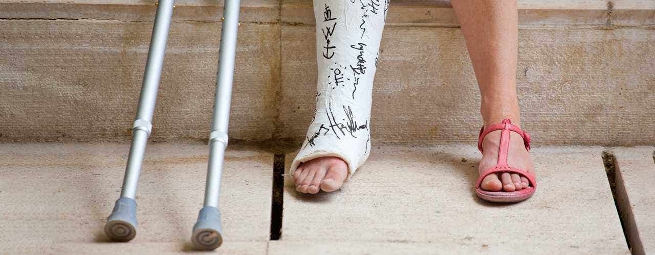 People With Traumatic Bone Fractures Often Have Low Levels Of Vitamin D
